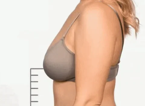 Front-button bra